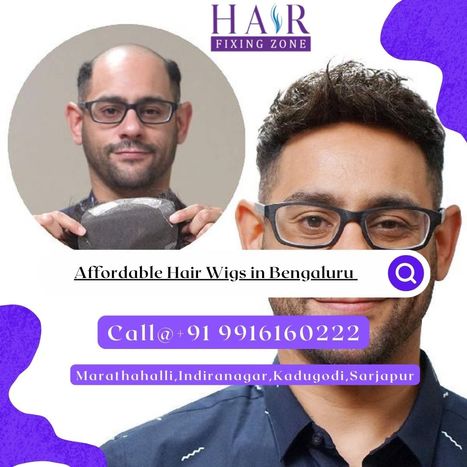 Affordable Non-surgical Hair Fixing in Bengaluru | hair fixing in bangalore | Scoop.it