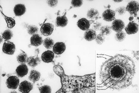 Un virus pourrait d&eacute;clencher la scl&eacute;rose en plaques | Microbiologie | Scoop.it