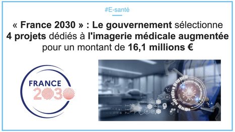 « France 2030 » : Le gouvernement sélectionne 4 projets dédiés à l'imagerie médicale augmentée pour un montant de 16,1 millions € | innovation & e-health | Scoop.it