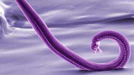 Scientists complete first complete map of an animal's nervous system in a "major milestone" | Amazing Science | Scoop.it