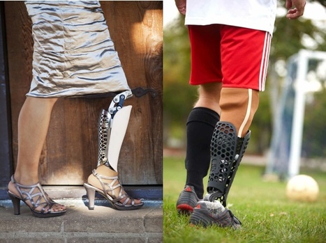 3D Printed Prosthetics Company Bespoke Acquired By 3D Systems | Science News | Scoop.it