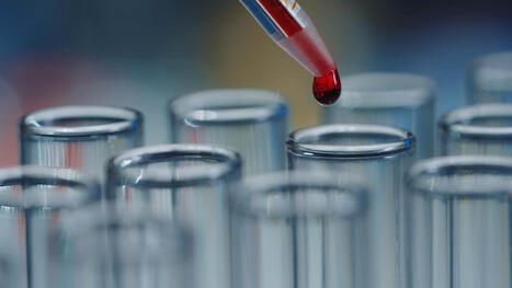 Fall av ”bibliska” sjukdomen spetälska upptäckta i Europa | 1Uutiset - Lukemisen tähden | Scoop.it