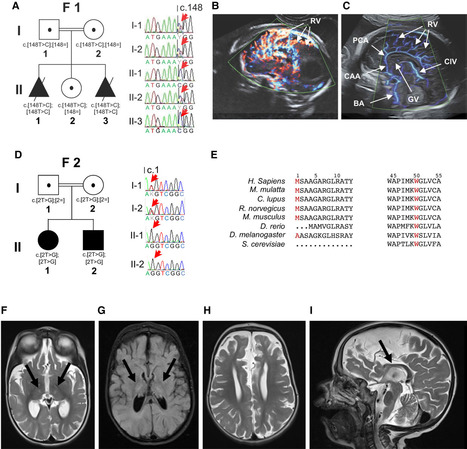 Des variants dans le g&egrave;ne MPC2 perturbent le m&eacute;tabolisme mitochondrial du pyruvate et provoquent une mitochondriopathie &agrave; d&eacute;but pr&eacute;coce | Life Sciences Universit&eacute; Paris-Saclay | Scoop.it