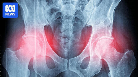 Study backing OsteoStrong 'bone-strengthening' exercise program should be retracted: experts. | Hospitals and Healthcare | Scoop.it