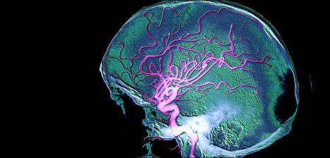 Alzheimer : les espoirs de la piste sanguine. - CNRS | Mécanique des fluides | Scoop.it