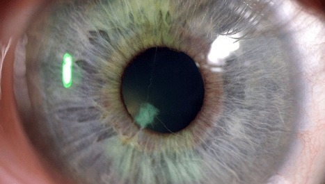 Les projections oculaires du frelon asiatique | EntomoNews | Scoop.it
