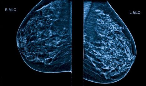 AI software diagnoses cancer risk 30 times faster than doctors and with 99% accuracy | Amazing Science | Scoop.it