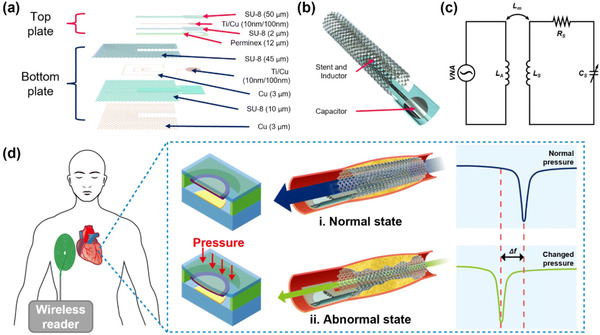 Stress induced self-rollable smart-stent-based U-health platform for in-stent restenosis monitoring | Neurovascular Intervention | Scoop.it