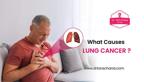 What Causes Lung Cancer in 2022? | Lung Cancer Treatment in Jaipur | Cancer Treatment and Cancer therapies | Scoop.it