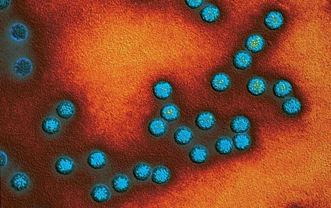 New York Polio Case Revives Questions about Live Oral Vaccine | Amazing Science | Scoop.it