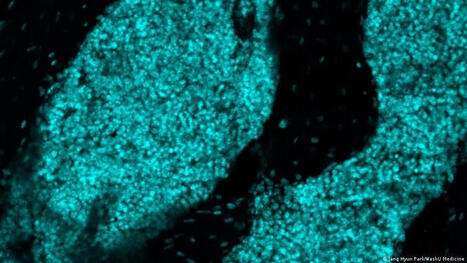 Scientists discover new 'immune hubs' in skull bone marrow | George Niles Mekeel | NeuroImmunology | Scoop.it