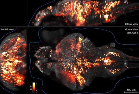 Whole brain cellular-level activity mapping in a second | Daily Magazine | Scoop.it