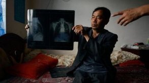 Les poumons brûlés du dragon chinois | Chine | FRANCE 24 | Management contemporain à l'innovation managériale - Droit social | Scoop.it