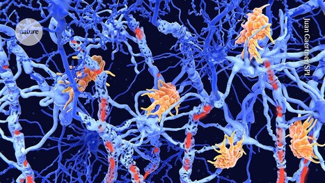 CAR-T cells drive into progressive multiple sclerosis | Multiple sclerosis | Scoop.it