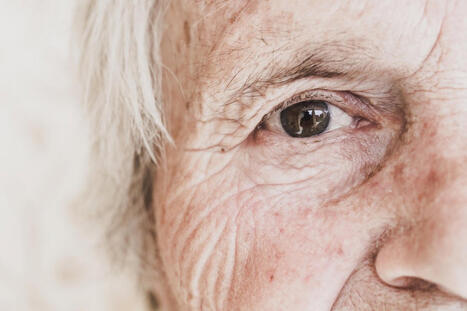 Expertas abogan por "intervenir desde fases tempranas para prevenir la desnutrici&oacute;n y la sarcopenia" en Alzheimer | Alzheimer y m&aacute;s (Bolet&iacute;n n&ordm; 90) | Scoop.it