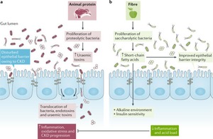 Plant-based diets to manage the risks and complications of chronic kidney disease | Peritoneal dialysis | Scoop.it