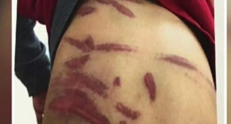 Indiana woman uses state &lsquo;religious freedom&rsquo; law to justify lashing son with coat hanger - RawStory.com | Operation Phobos | Scoop.it
