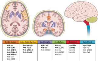 Brain on fire: an imaging-based review of autoimmune encephalitis | AntiNMDA | Scoop.it