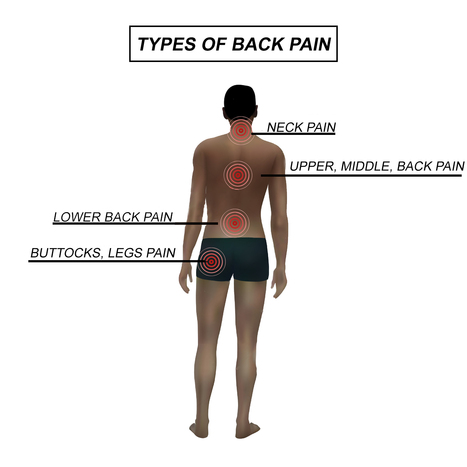 Back Pain Center: Upper, Mid & Lower Back Call 915-850-0900 | Spine Health & Spinal Hygiene | Scoop.it