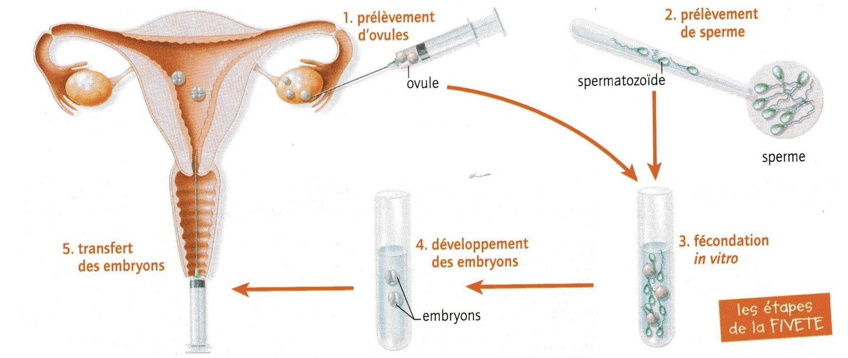 Les Methodes De Procreation Medicalement Assistee Svt