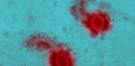 Demain, des virus au service de la médecine pour traiter des cancers, comme alternatives aux antibiotiques notamment | EntomoScience | Scoop.it