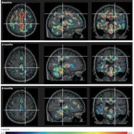 Frank Bernier, PhD, MSc, CIP on LinkedIn: The immune system is increasingly recognized as a key player in… | NeuroImmunology | Scoop.it
