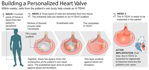 Early Feasibility Study of a Hybrid Tissue-Engineered Mitral Valve in an Ovine Model | Transcatheter Treatment of Mitral Regurgitation | Scoop.it