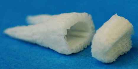 Stem-Cell Dental Implants Grow New Teeth Right In Your Mouth | Health Supreme | Scoop.it