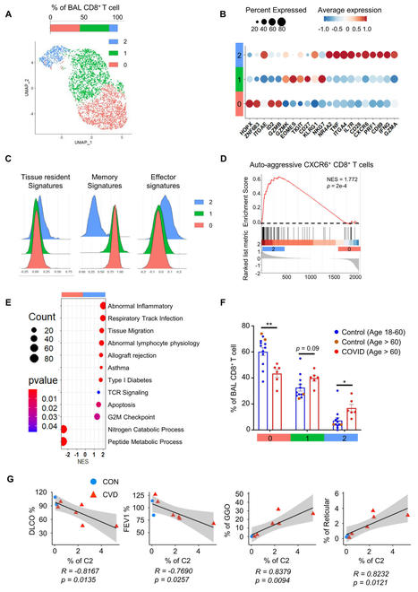 Immune signatures underlying post-acute COVID-19 lung sequelae | Mucosal Immunity | Scoop.it