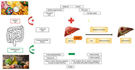 Habitudes alimentaires et carcinome hépatocellulaire : implications cliniques | Life Sciences Université Paris-Saclay | Scoop.it