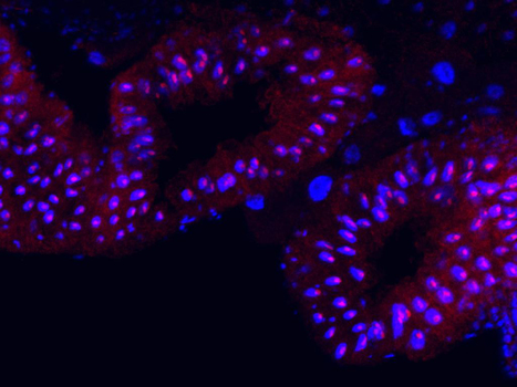 Jouvence un petit ARN nucléolaire nécessaire dans l'intestin prolonge la durée de vie chez la drosophile | Life Sciences Université Paris-Saclay | Scoop.it