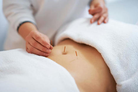 Acupuncture for Ulcerative Colitis: How It Can Help - EP Wellness & Functional Medicine Clinic | Call: 915-850-0900 or 915-412-6677 | The Gut "Connections to Health & Disease" | Scoop.it