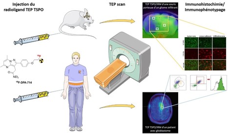 La TEP TSPO pour l’imagerie du gliome et de son microenvironnement | Life Sciences Université Paris-Saclay | Scoop.it
