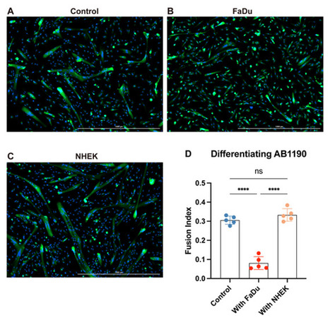 Atrophie musculaire dans les carcinomes des voies a&eacute;ro-digestives sup&eacute;rieures : analyse d&rsquo;&eacute;chantillons cliniques et mod&eacute;lisation in vitro | Life Sciences Universit&eacute; Paris-Saclay | Scoop.it