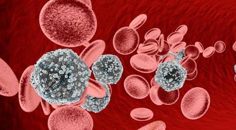 Les recherches sur un vaccin du SIDA suspendues par le CNRS, &ccedil;a pue le conflit d'int&eacute;r&ecirc;t selon la pr&eacute;sidente du laboratoire | ACTUALIT&Eacute; | Scoop.it
