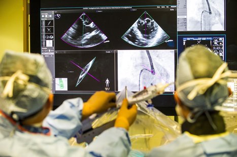 MitraClip May Be a Powerful Treatment for Heart Failure, Study Says | Hospitals and Healthcare | Scoop.it
