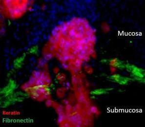 Tissue-engineered model of human colon should improve cancer research | Buzz e-sante | Scoop.it