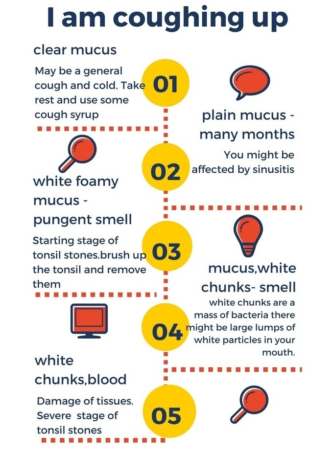 Tonsil stones Remedies | Scoop.it