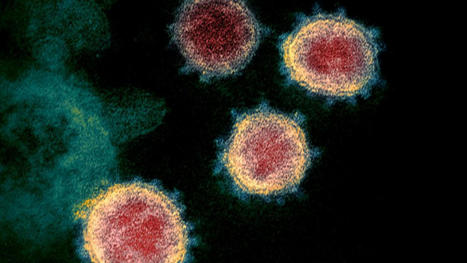 FDA authorizes new T-cell test that could be game changer for COVID-19 long haulers | Laboratory Medicine | Scoop.it
