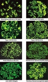 My collection of Educational Immunopathology and Immunology images and videos is growing. Suggestions wellcomed | Immunology for University Students | Scoop.it